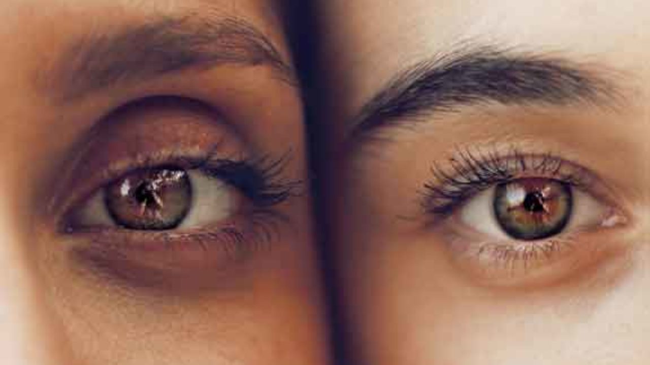 17 Cara menghilangkan kantung mata secara alami dan cepat