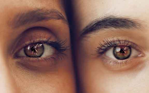 Cara menghilangkan kantung mata secara alami