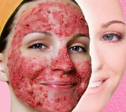 manfaat kulit manggis untuk wajah